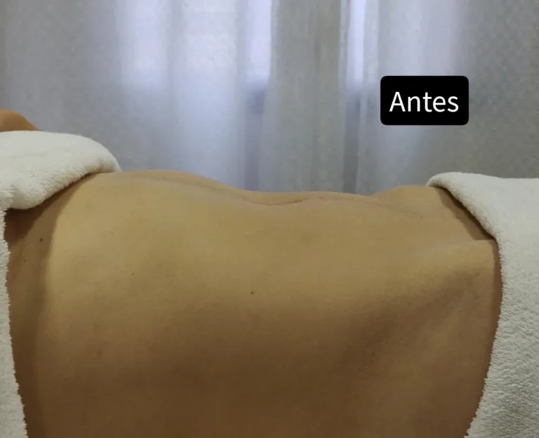 Estética corporal · Espaço Aliáh Saúde e Beleza — salão de beleza em Jardim das Tulipas, Holambra - SP