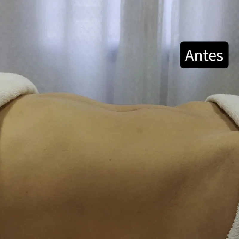 Estética corporal · Espaço Aliáh Saúde e Beleza — salão de beleza em Jardim das Tulipas, Holambra - SP