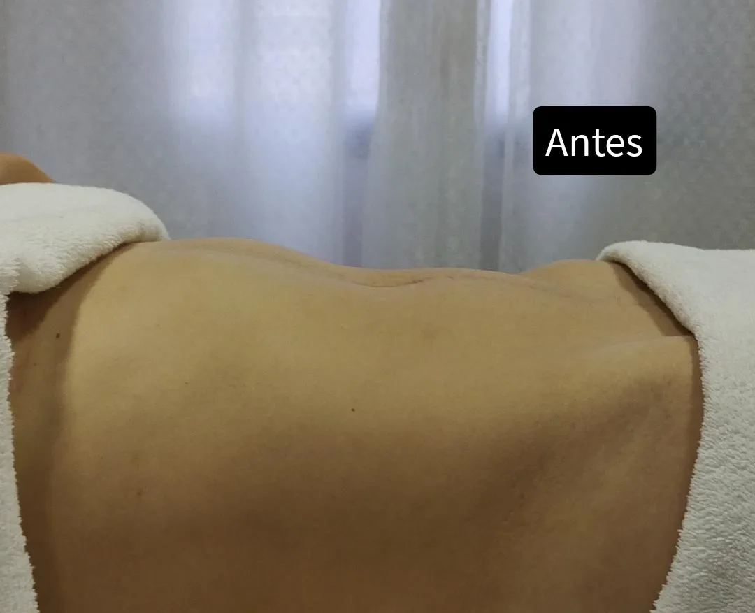 Drenagem linfática em Holambra: Reduza inchaços e melhore a circulação